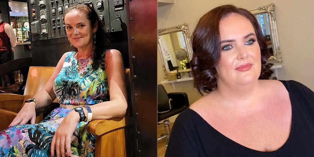 Sarah M before and after weight loss surgery with Blackrock WeightCare and Dr William Robb