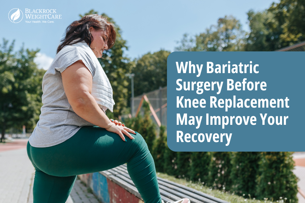 knee replacement surgery