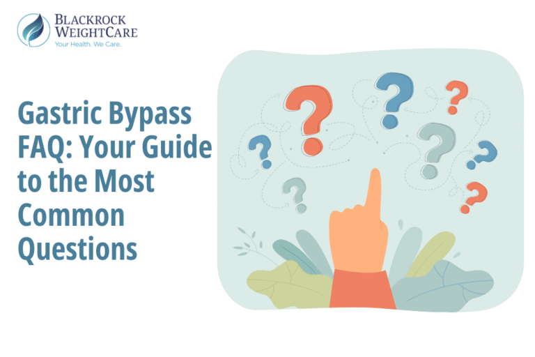 Gastric Bypass FAQ