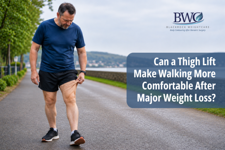 Thigh Lift after weight loss surgery